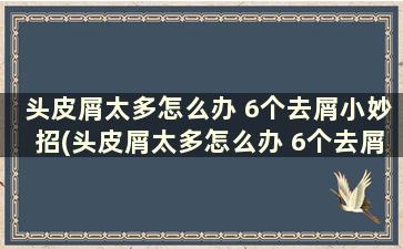 头皮屑太多怎么办 6个去屑小妙招(头皮屑太多怎么办 6个去屑小妙招)